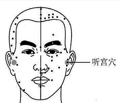 睡眠不好按按听宫