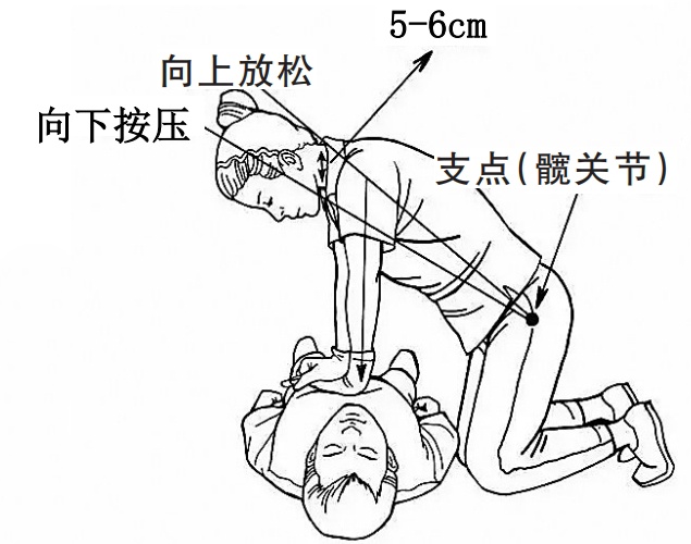 心肺复苏术 每个人都应该掌握