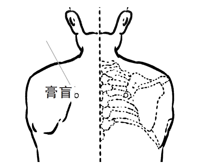 三伏天 治疗鼻炎事半功倍