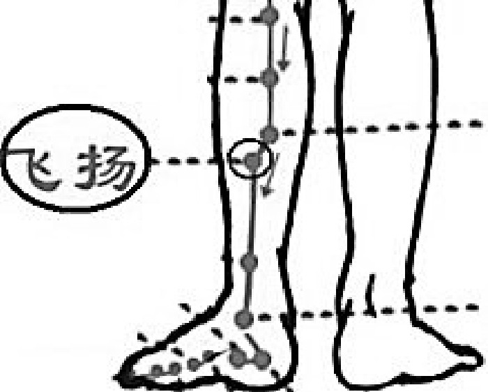 腰腿疼痛按揉飞扬穴