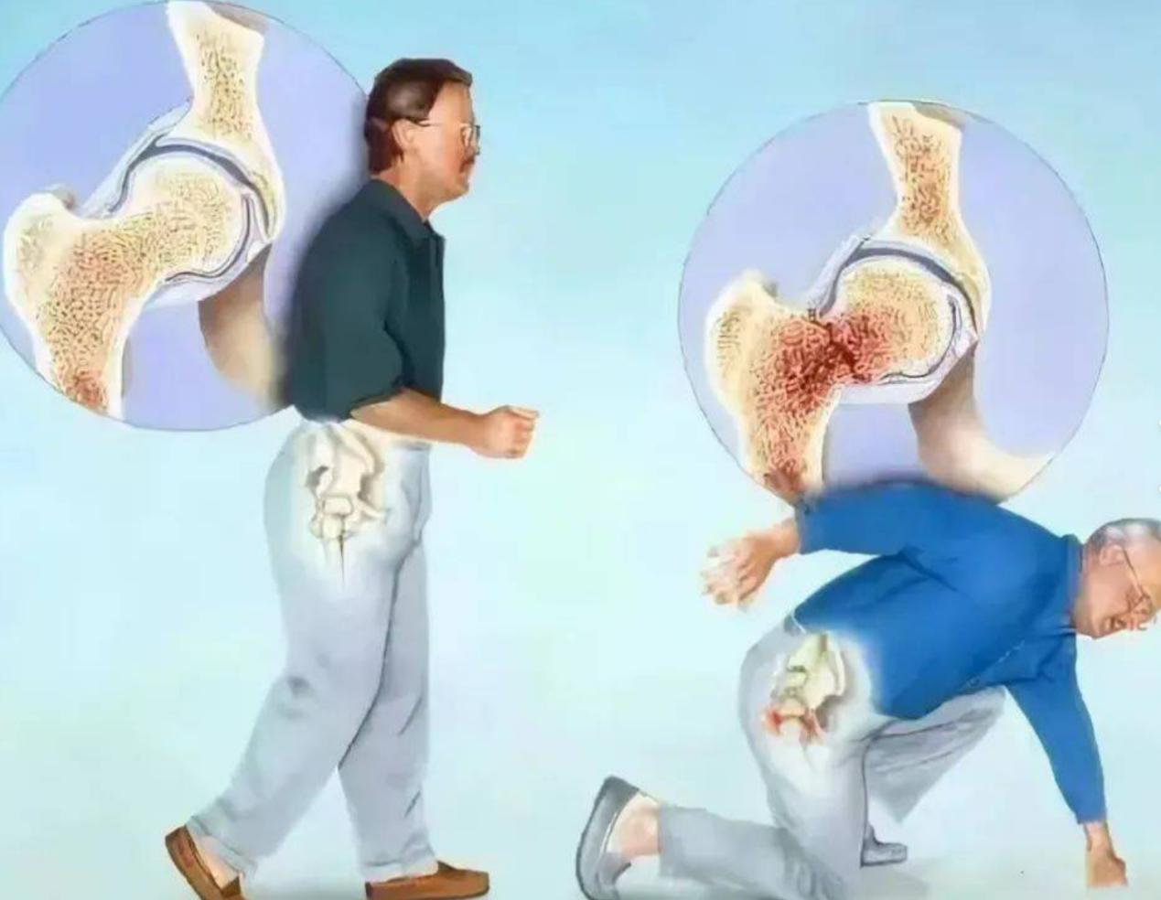 骨折和脱位了，还能自己动吗？
