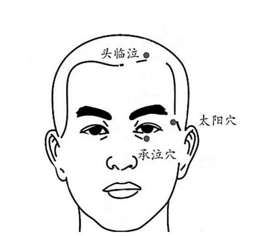 头痛、耳聋按压头临泣穴