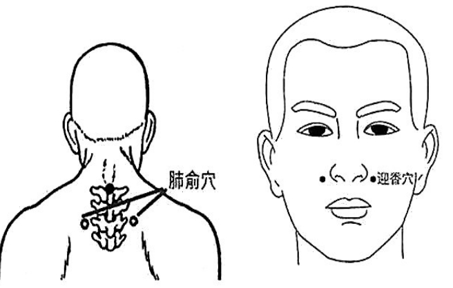 清痰、防感冒 按迎香、叩肺俞