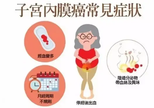 子宫内膜癌——防治新认识