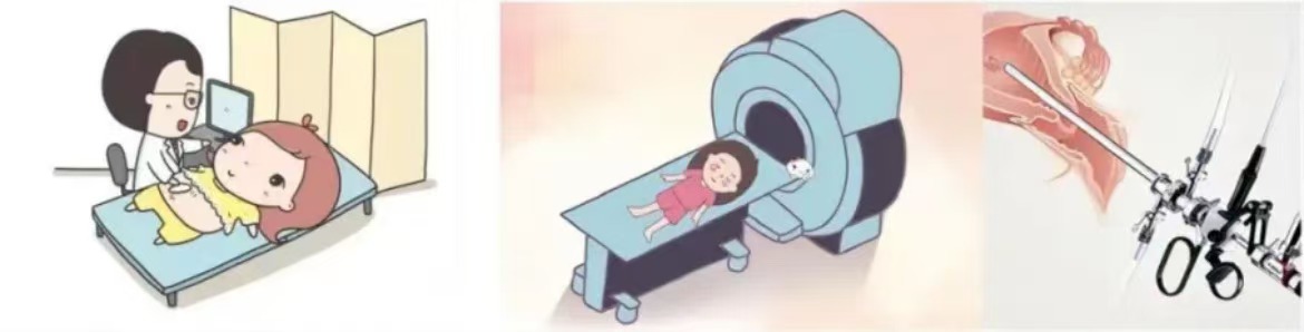 子宫内膜癌——防治新认识