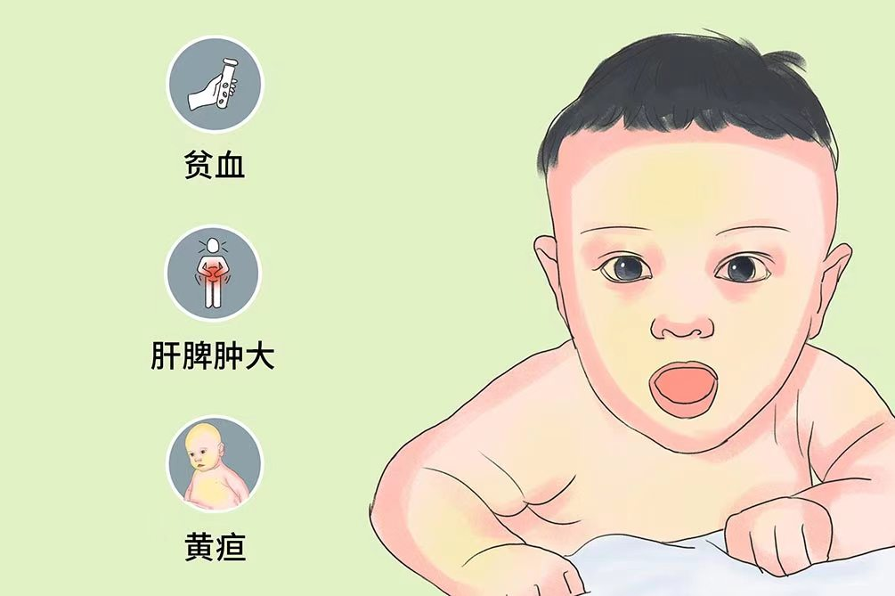 新生儿高胆红素血症，家长如何应对？