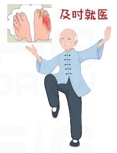 预防糖尿病足的小招数