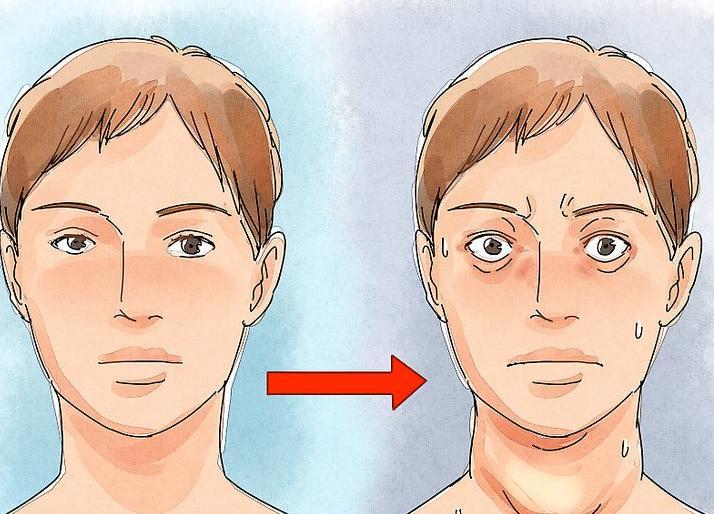 被“突眼”改写的人生—— “拉住”失控的甲状腺