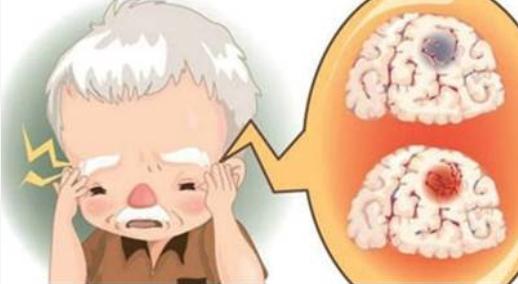 脑卒中患者应如何护理？