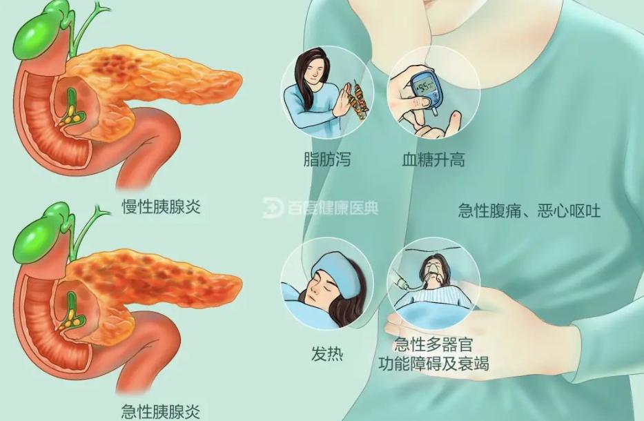 胰腺炎这种病，掉以轻心会要命！