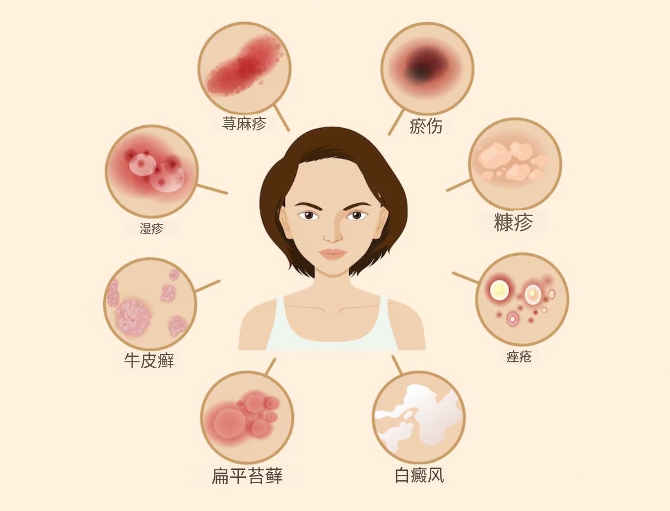 身上出现斑疹是怎么回事