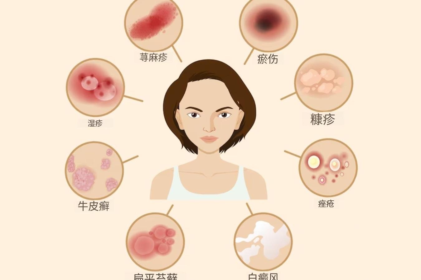 身上出现斑疹是怎么回事