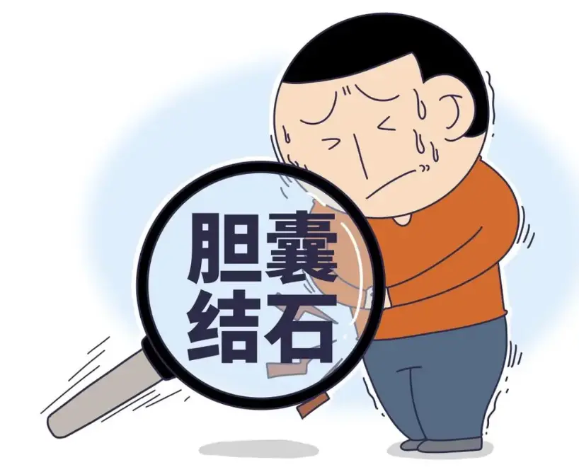 吃鸡蛋会引发胆结石发作吗？