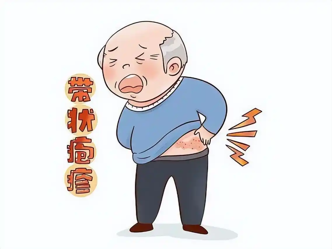 秋季带状疱疹高发中医教你应对