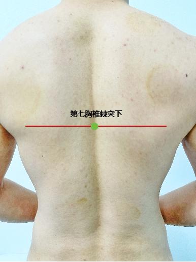 胃痛突然来袭？试试按压背上速效“暖心开关”