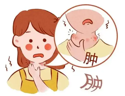 淋巴是身体疾病探测器