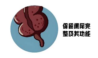 我的阑尾我做主——ERAT治疗术,守护肠道“小盲端”