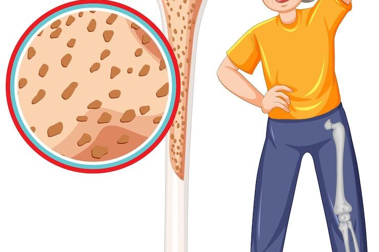 改善骨代谢 衰老慢两成