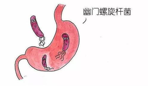 幽门螺杆菌阳性,到底要不要“杀”?治疗前必看的利弊权衡