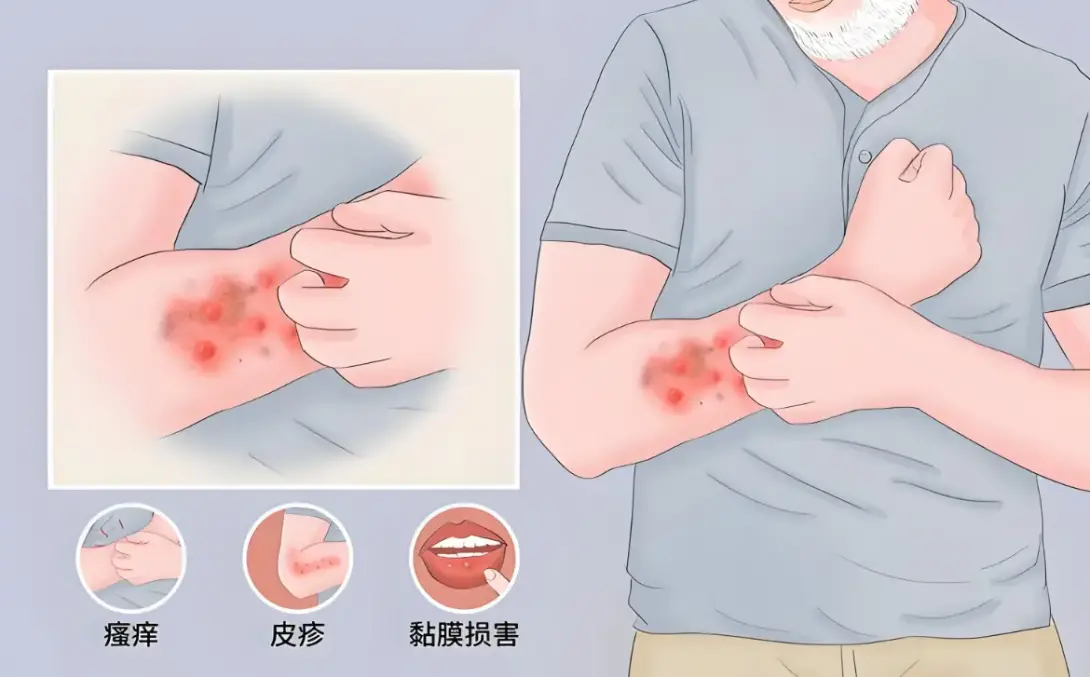 对症调肤 少走弯路