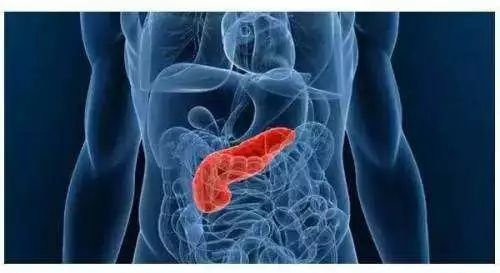 饱餐之后胃痛?警惕急性胰腺炎,别当成普通胃病